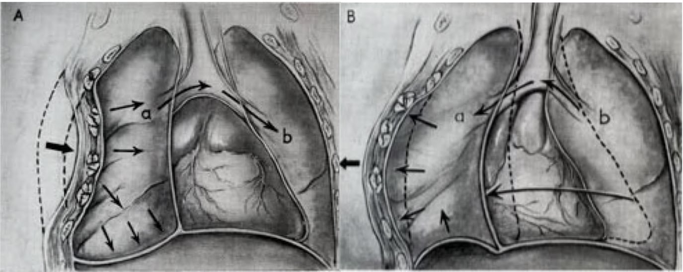 The Deadly Dozen The 12 Most Foreboding Chest Injuries Part I